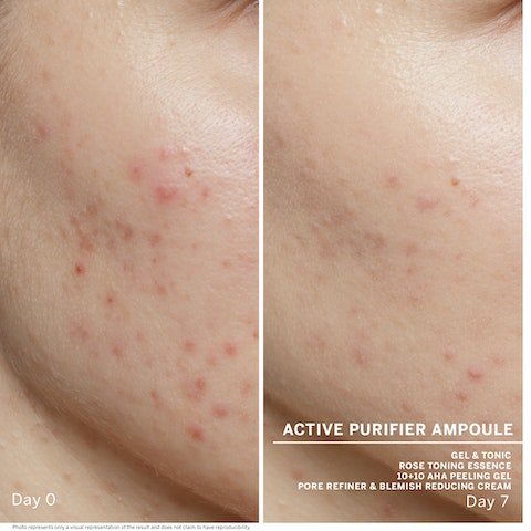 Babor Ampoule Concentrates - Active Purifier